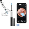 WaxWand - Wax Elimination Otoscope